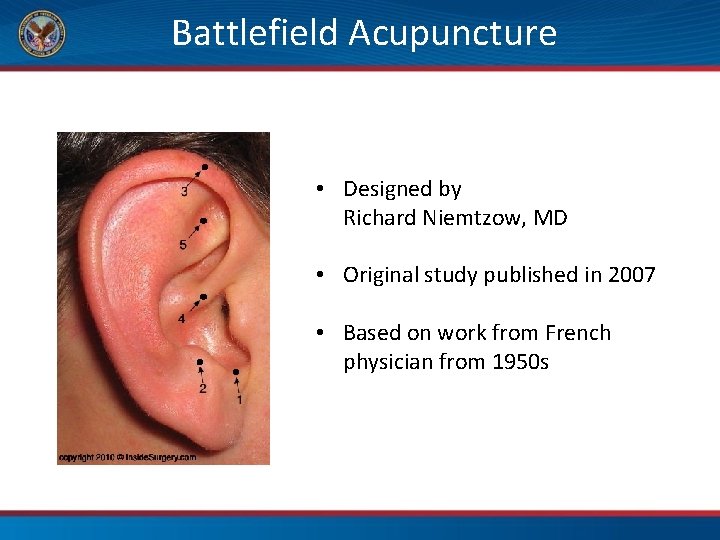 Battlefield Acupuncture • Designed by Richard Niemtzow, MD • Original study published in 2007