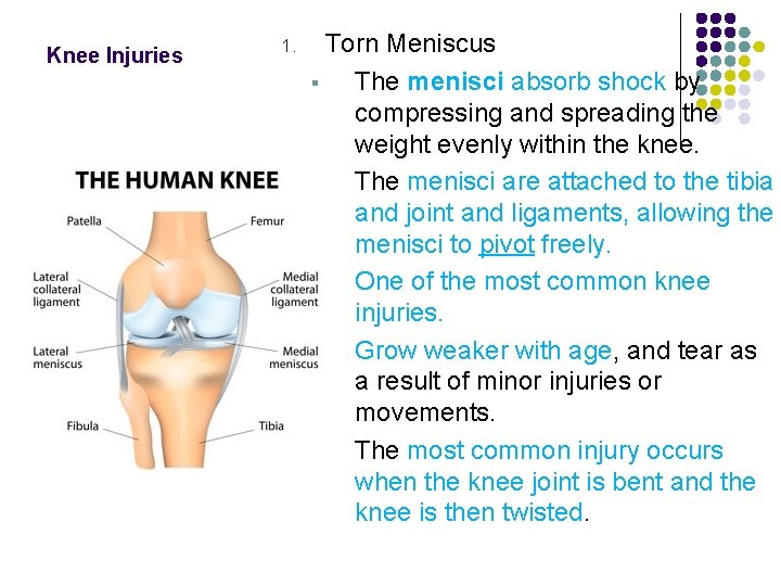 Knee Injuries 1. Torn Meniscus § The menisci absorb shock by compressing and spreading