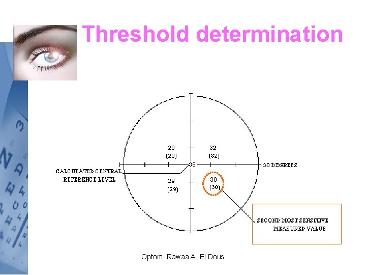 Threshold determination Optom. Rawaa A. El Dous 