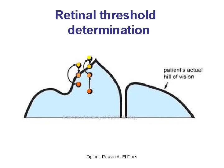 Retinal threshold determination Optom. Rawaa A. El Dous 