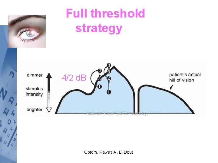 Full threshold strategy 4/2 d. B Optom. Rawaa A. El Dous 