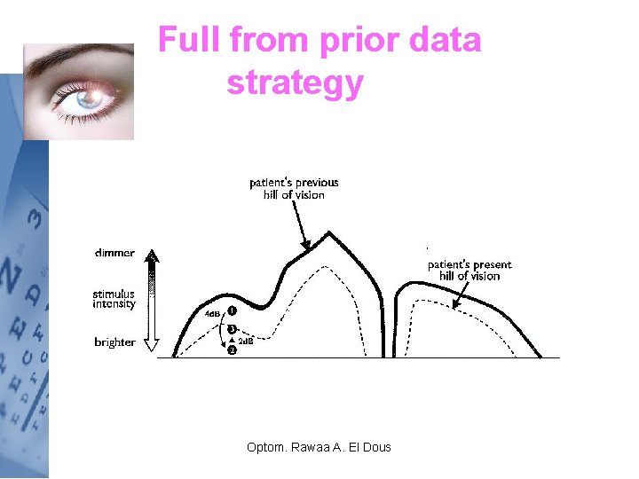 Full from prior data strategy Optom. Rawaa A. El Dous 