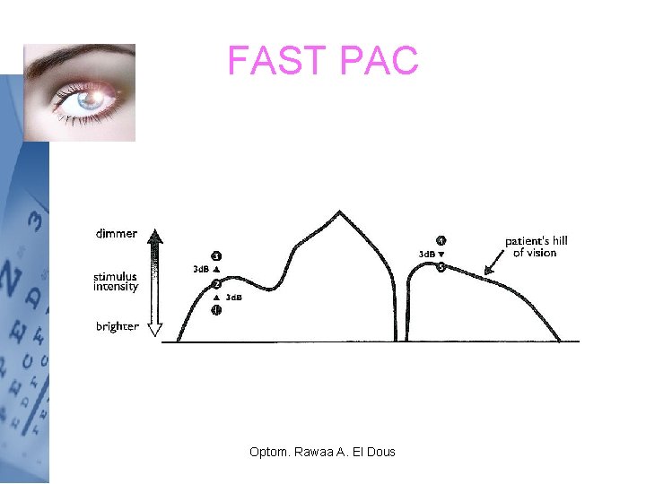 FAST PAC Optom. Rawaa A. El Dous 