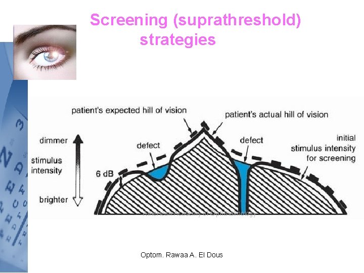 Screening (suprathreshold) strategies Optom. Rawaa A. El Dous 