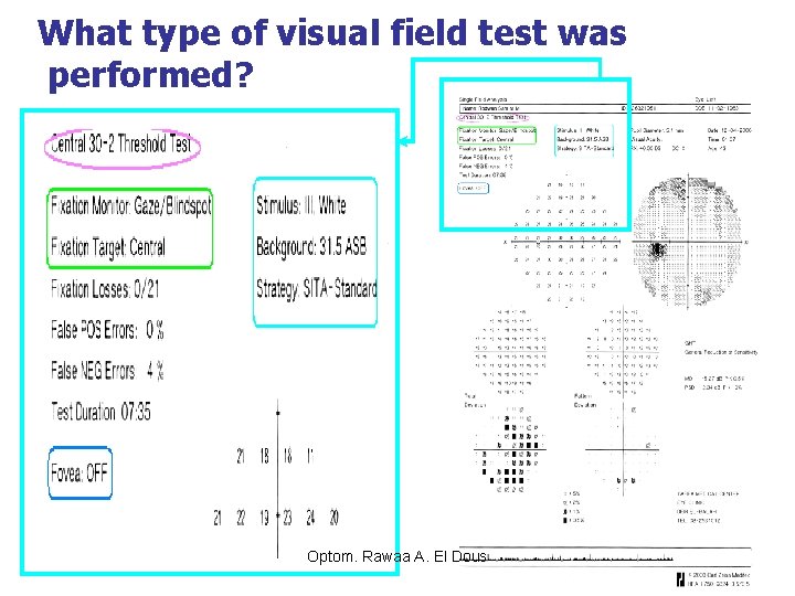 What type of visual field test was performed? Optom. Rawaa A. El Dous 