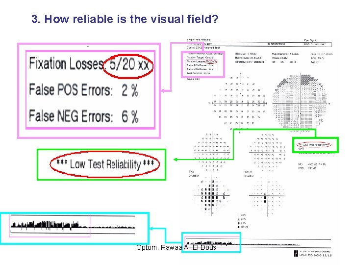 3. How reliable is the visual field? Optom. Rawaa A. El Dous 