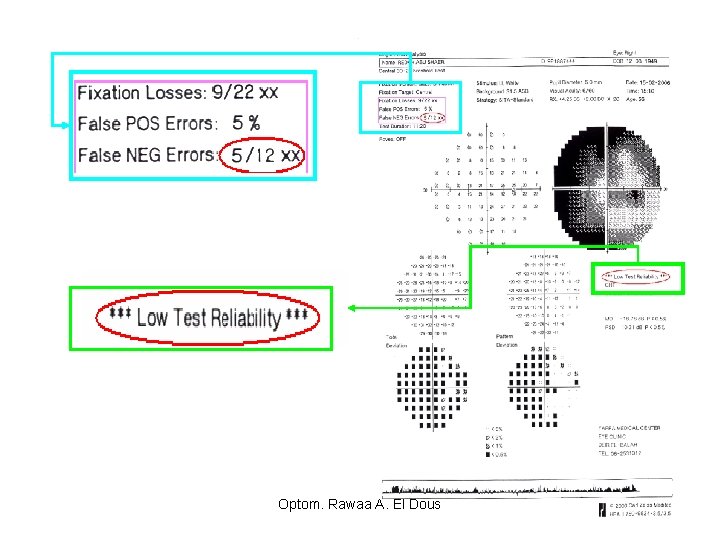 Optom. Rawaa A. El Dous 