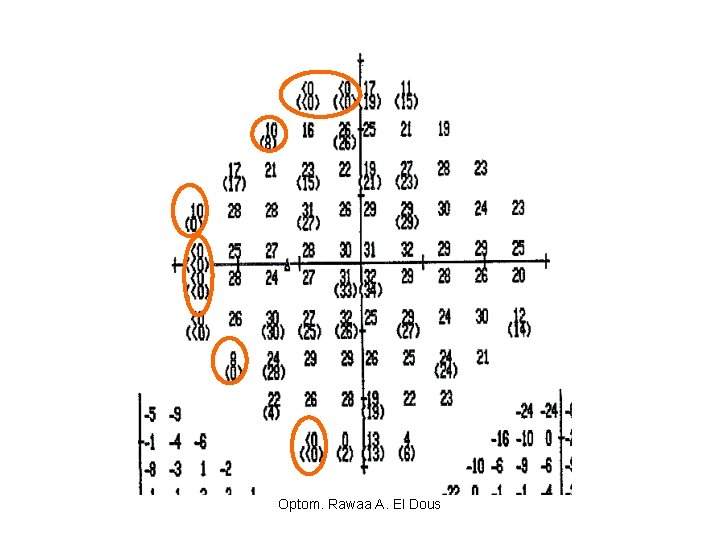 Optom. Rawaa A. El Dous 