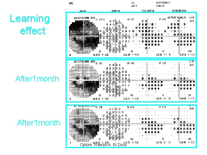 Learning effect After 1 month Optom. Rawaa A. El Dous 