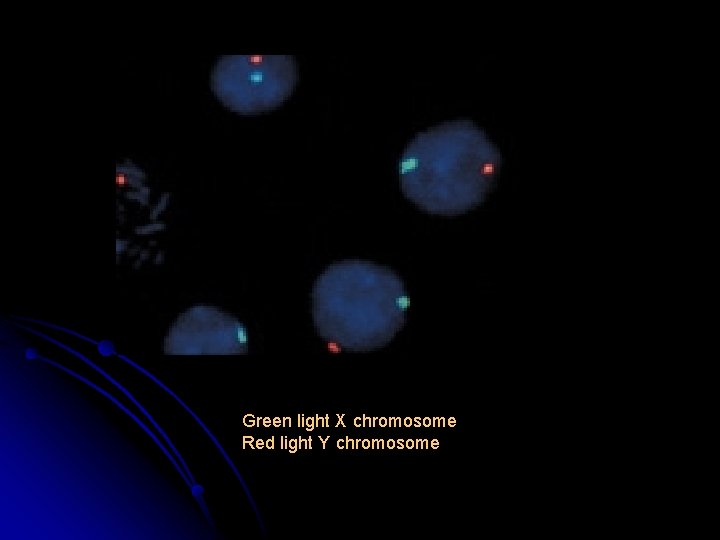 Green light X chromosome Red light Y chromosome 