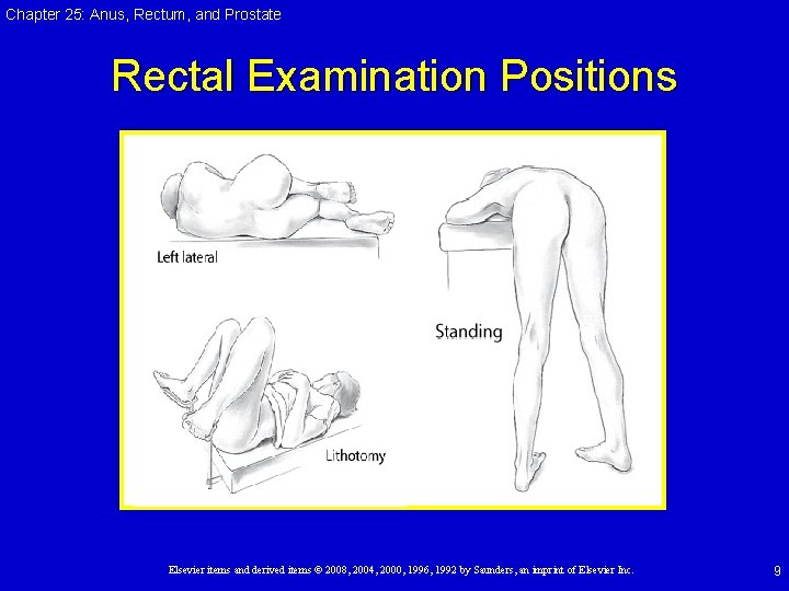 Chapter 25: Anus, Rectum, and Prostate Rectal Examination Positions Elsevier items and derived items Chapter 25: Anus, Rectum, and Prostate Rectal Examination Positions Elsevier items and derived items