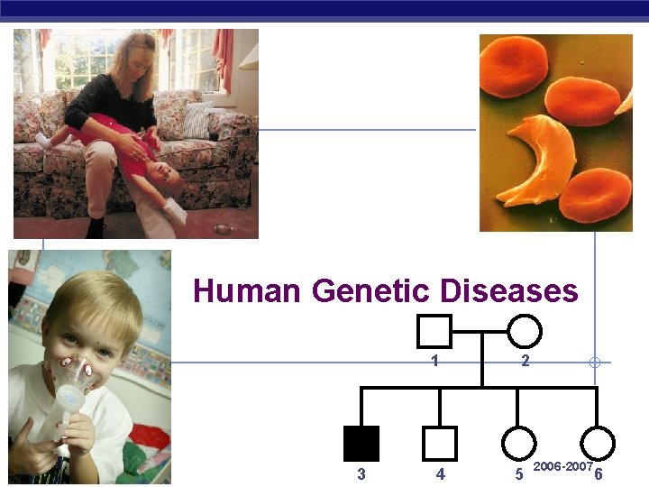 Human Genetic Diseases 1 AP Biology 3 4 2 5 2006 -2007 6 