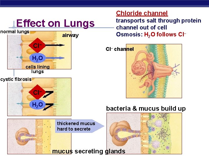 Chloride channel Effect on Lungs normal lungs airway Cl– transports salt through protein channel