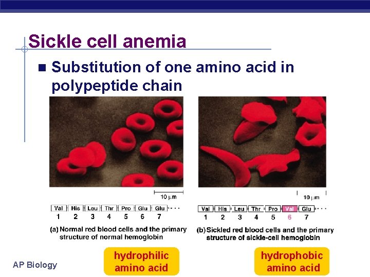 Sickle cell anemia n Substitution of one amino acid in polypeptide chain AP Biology