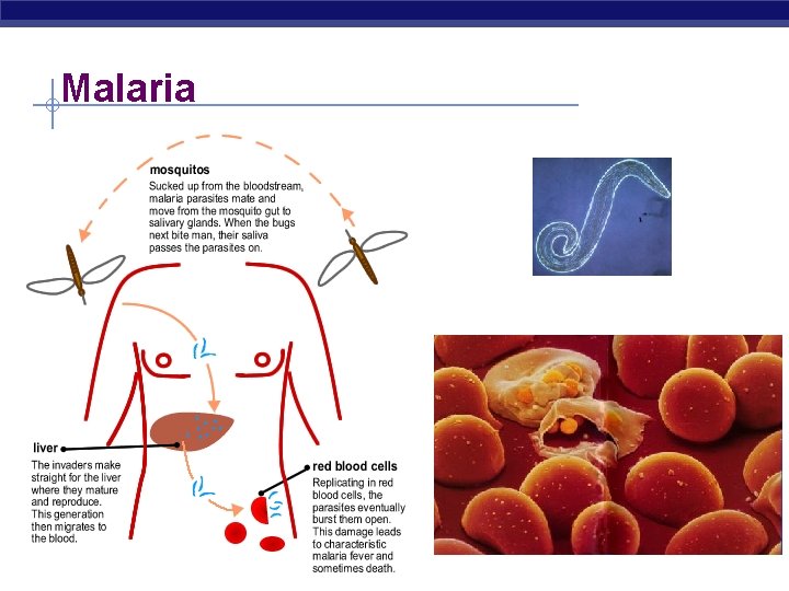 Malaria AP Biology 