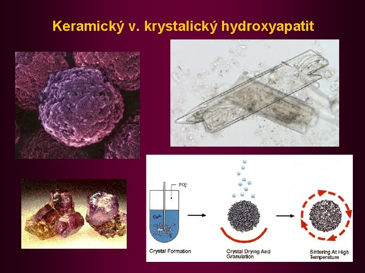 Keramický v. krystalický hydroxyapatit 