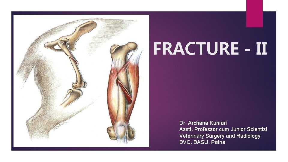 FRACTURE - II . Dr. Archana Kumari Asstt. Professor cum Junior Scientist Veterinary Surgery