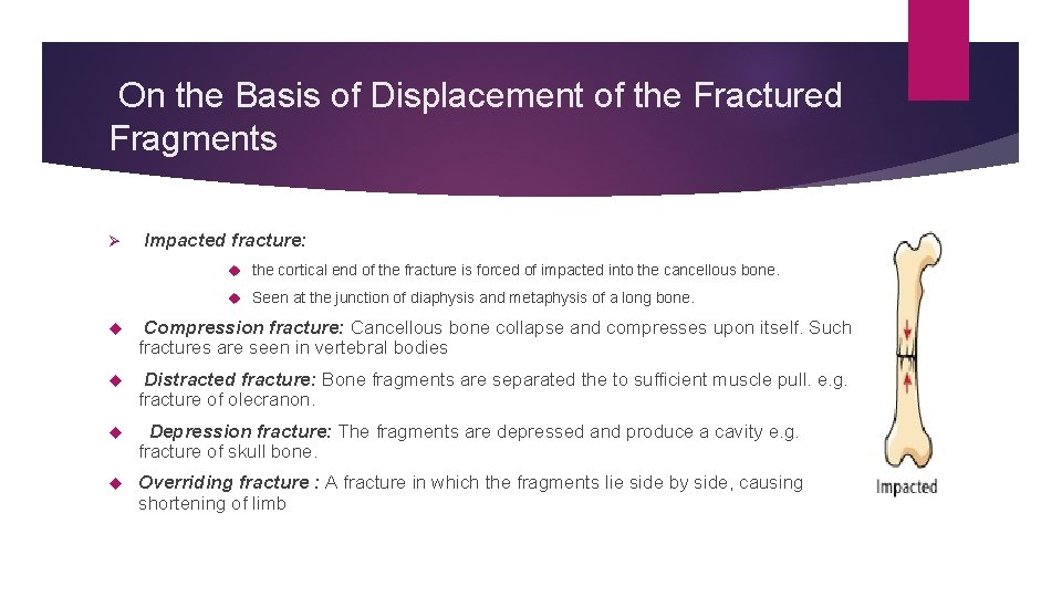 On the Basis of Displacement of the Fractured Fragments Ø Impacted fracture: the cortical