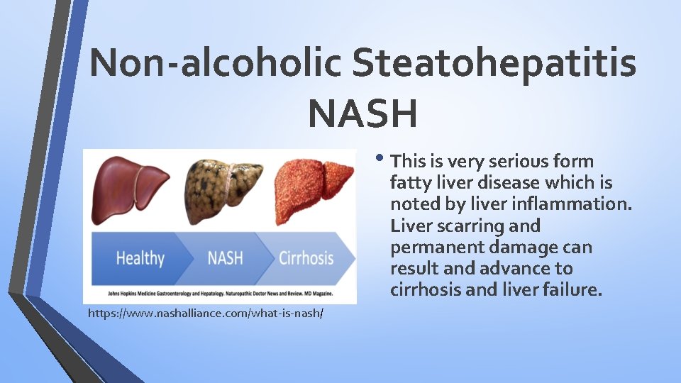 Non-alcoholic Steatohepatitis NASH • This is very serious form fatty liver disease which is