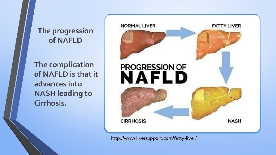 The progression of NAFLD The complication of NAFLD is that it advances into NASH