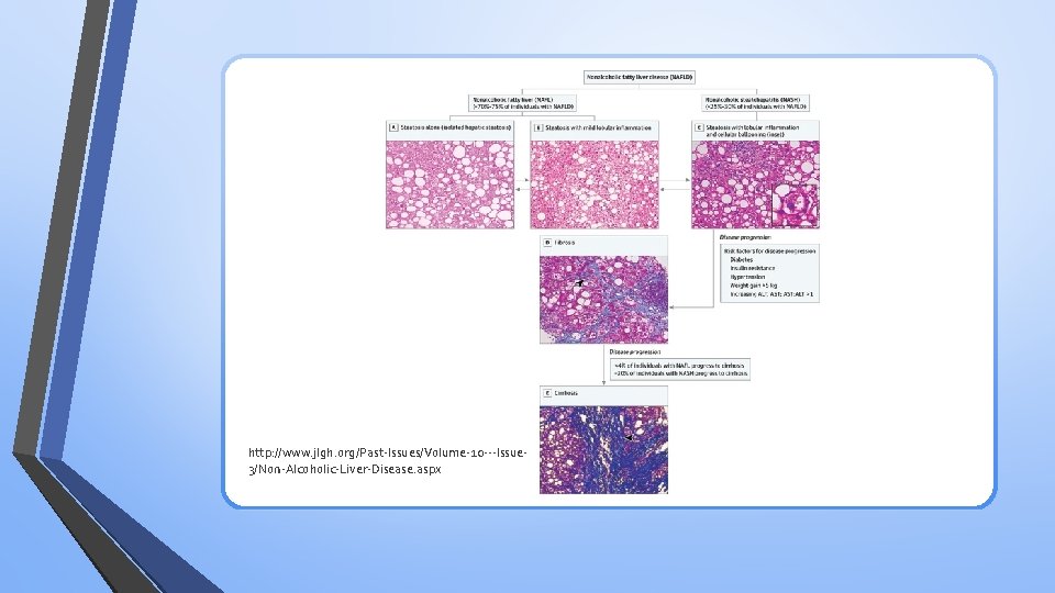 http: //www. jlgh. org/Past-Issues/Volume-10 ---Issue 3/Non-Alcoholic-Liver-Disease. aspx 