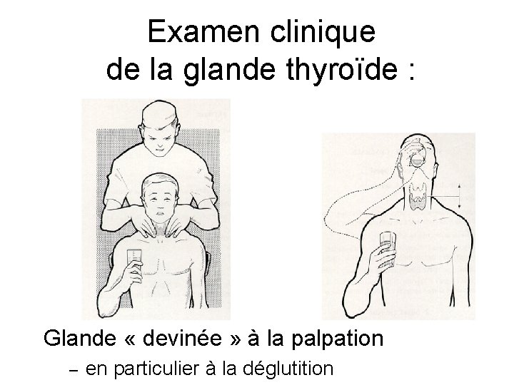 Examen clinique de la glande thyroïde : Glande « devinée » à la palpation