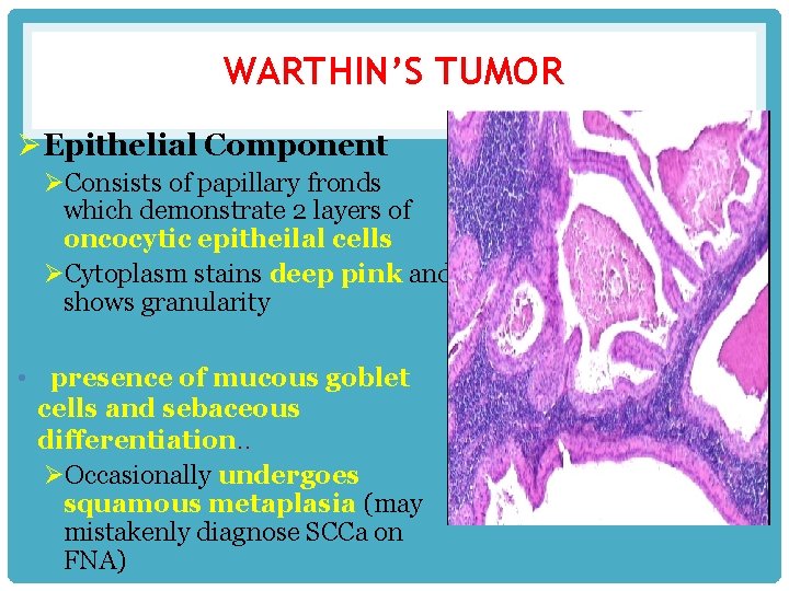 WARTHIN’S TUMOR ØEpithelial Component ØConsists of papillary fronds which demonstrate 2 layers of oncocytic