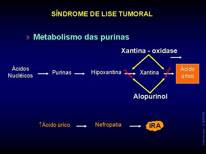 SÍNDROME DE LISE TUMORAL » Metabolismo das purinas Xantina - oxidase Purinas Hipoxantina Xantina