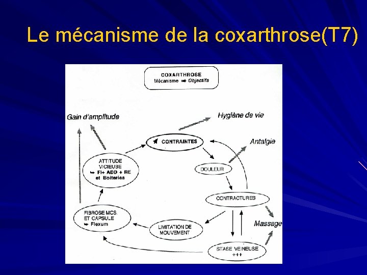 Le mécanisme de la coxarthrose(T 7) 