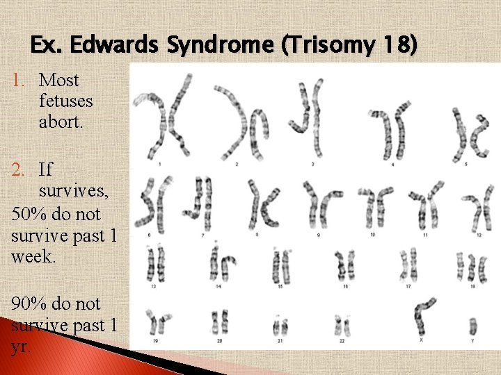 Ex. Edwards Syndrome (Trisomy 18) 1. Most fetuses abort. 2. If survives, 50% do