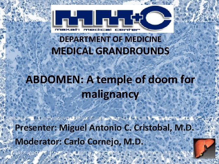DEPARTMENT OF MEDICINE MEDICAL GRANDROUNDS ABDOMEN: A temple of doom for malignancy Presenter: Miguel