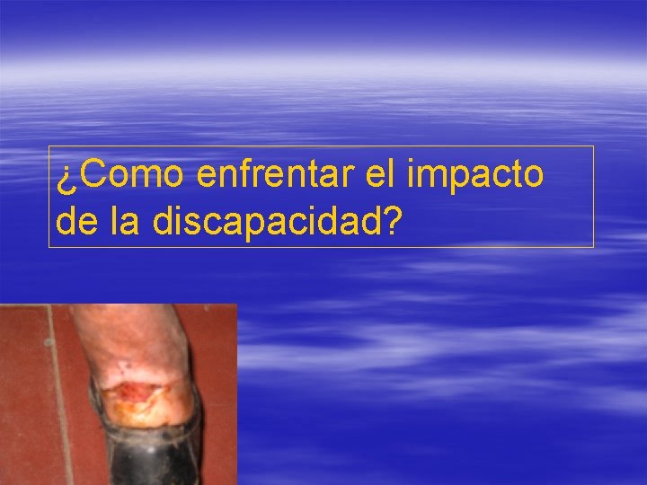 ¿Como enfrentar el impacto de la discapacidad? ¿Como enfrentar el impacto de la discapacidad?