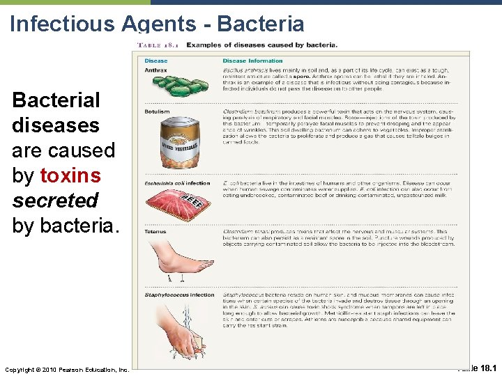 Infectious Agents - Bacterial diseases are caused by toxins secreted by bacteria. Copyright ©