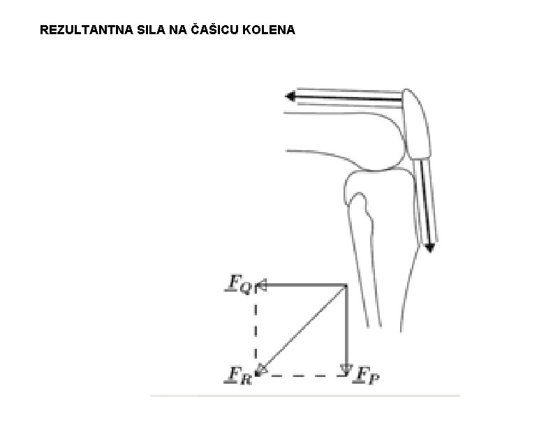 REZULTANTNA SILA NA ČAŠICU KOLENA 