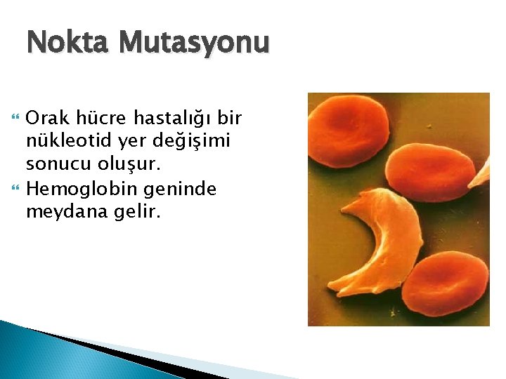 Nokta Mutasyonu Orak hücre hastalığı bir nükleotid yer değişimi sonucu oluşur. Hemoglobin geninde meydana