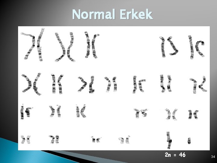 Normal Erkek 2 n = 46 34 