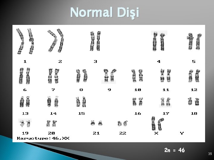 Normal Dişi 2 n = 46 35 
