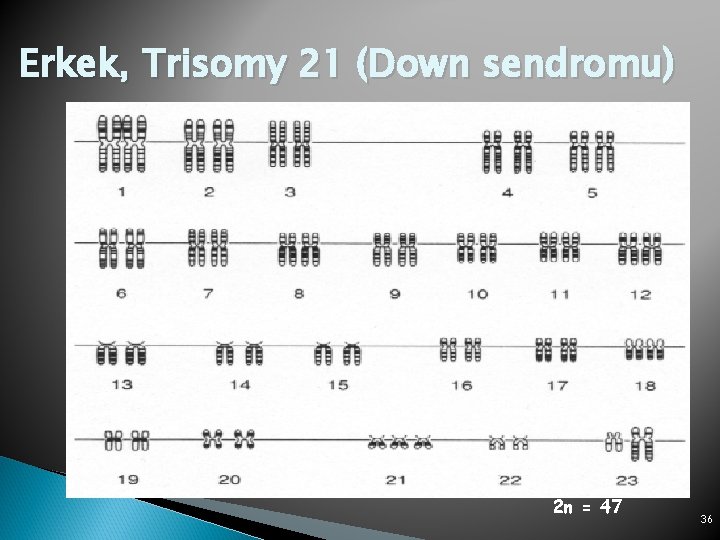 Erkek, Trisomy 21 (Down sendromu) 2 n = 47 36 