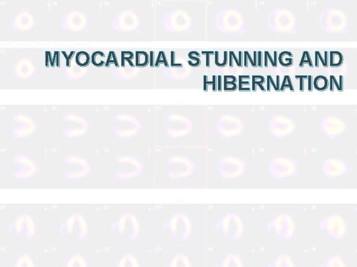 MYOCARDIAL STUNNING AND HIBERNATION 