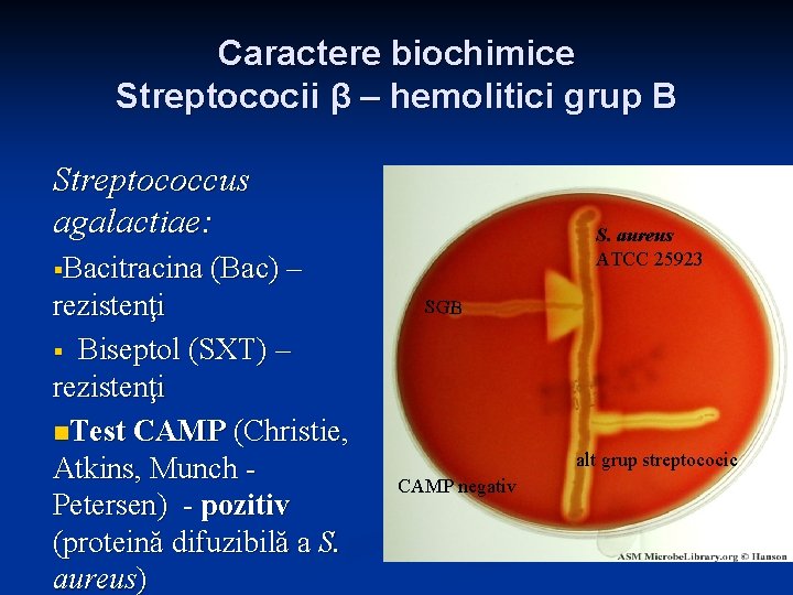 Caractere biochimice Streptococii β – hemolitici grup B Streptococcus agalactiae: S. aureus ATCC 25923 Caractere biochimice Streptococii β – hemolitici grup B Streptococcus agalactiae: S. aureus ATCC 25923