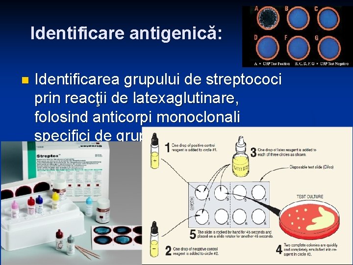 Identificare antigenică: n Identificarea grupului de streptococi prin reacţii de latexaglutinare, folosind anticorpi monoclonali Identificare antigenică: n Identificarea grupului de streptococi prin reacţii de latexaglutinare, folosind anticorpi monoclonali