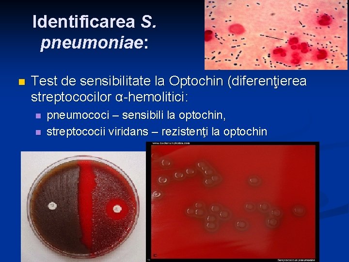 Identificarea S. pneumoniae: n Test de sensibilitate la Optochin (diferenţierea streptococilor α-hemolitici: n n Identificarea S. pneumoniae: n Test de sensibilitate la Optochin (diferenţierea streptococilor α-hemolitici: n n