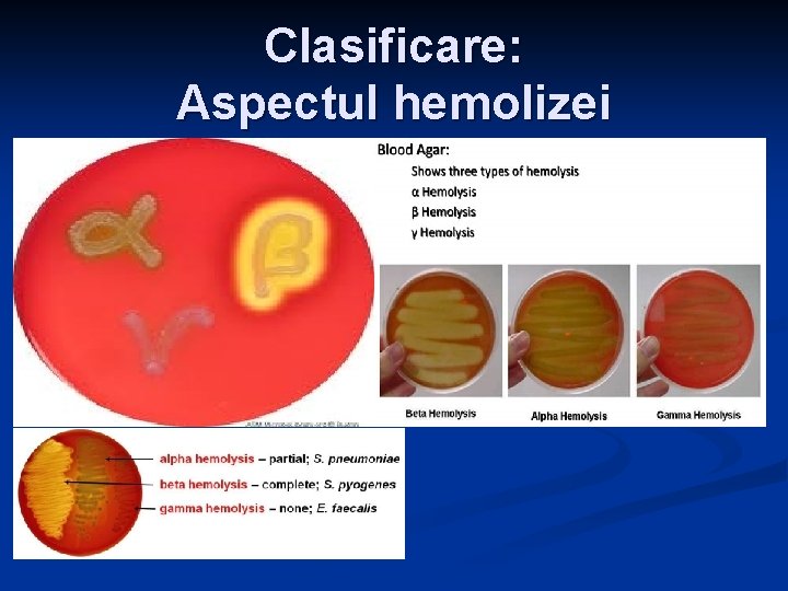 Clasificare: Aspectul hemolizei Clasificare: Aspectul hemolizei