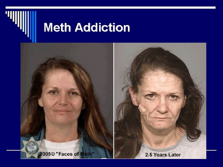 Meth Addiction 