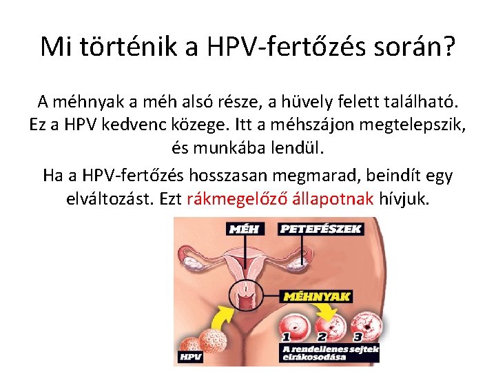 Mi történik a HPV-fertőzés során? A méhnyak a méh alsó része, a hüvely felett