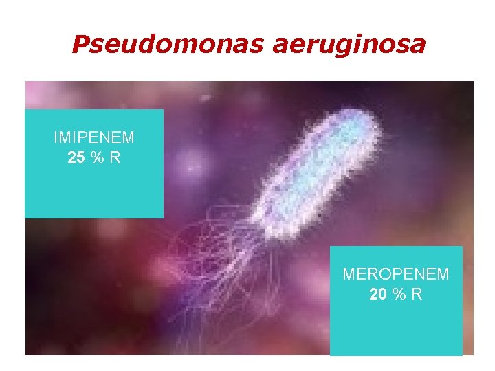 Pseudomonas aeruginosa IMIPENEM 25 % R MEROPENEM 20 % R Pseudomonas aeruginosa IMIPENEM 25 % R MEROPENEM 20 % R