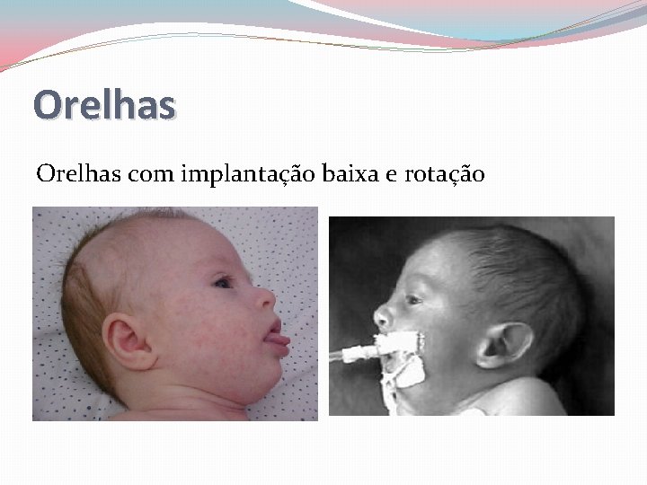 Orelhas com implantação baixa e rotação 