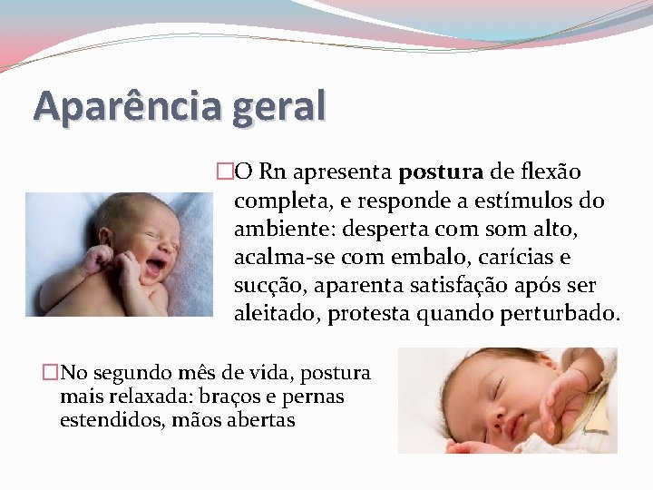 Aparência geral �O Rn apresenta postura de flexão completa, e responde a estímulos do