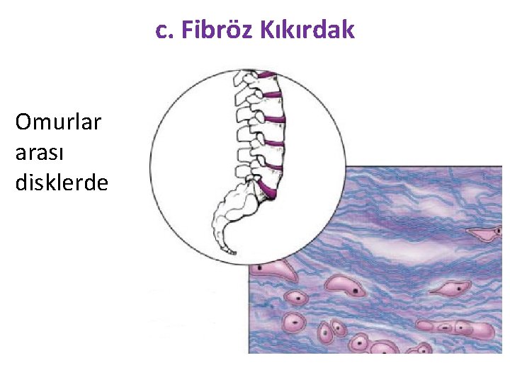 c. Fibröz Kıkırdak Omurlar arası disklerde 