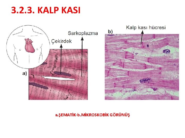 3. 2. 3. KALP KASI a. ŞEMATİK-b. MİKROSKOBİK GÖRÜNÜŞ 